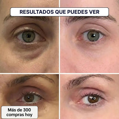 Transforma Arrugas y líneas finas de forma natural