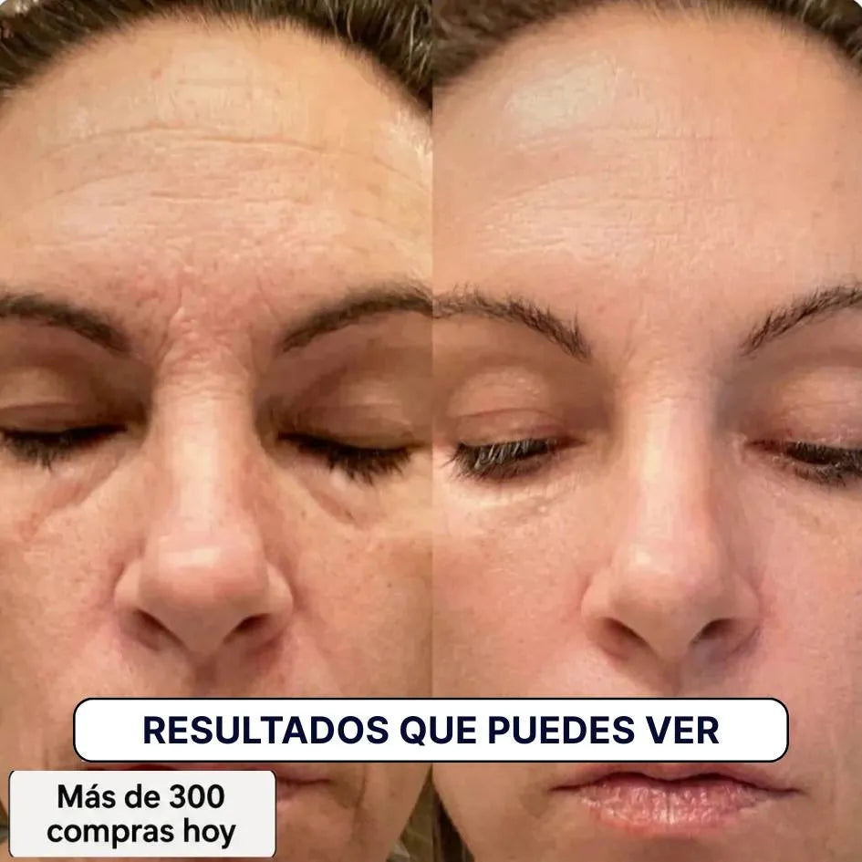 Transforma Arrugas y líneas finas de forma natural